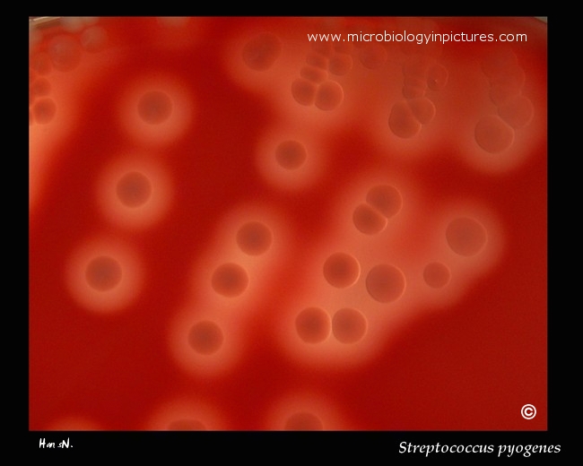 group a beta hemolytic strep icd 10